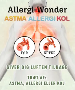 Allergi Wonder kategoriboks